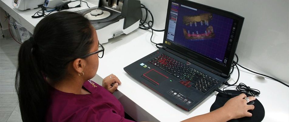 Diseño de Sonrisas Diseñado Digitalmente